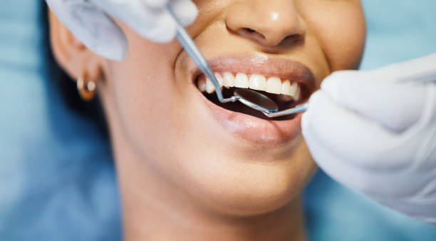Best Emergency Wisdom Tooth Extraction in Oak Grove, MS