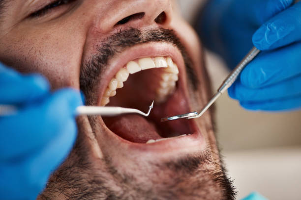 Best Walk-In Emergency Dental Services in Oak Grove, MS